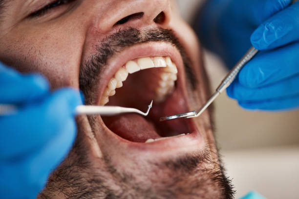 Best Emergency Dental Care for Trauma or Injury in Key Vista, FL