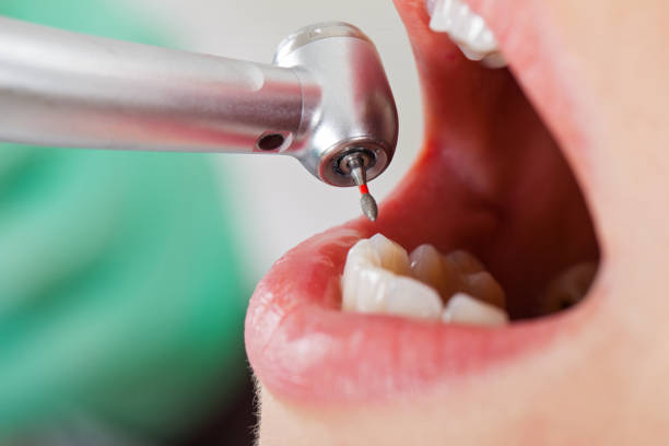 Best Emergency Dental Surgery in Key Vista, FL